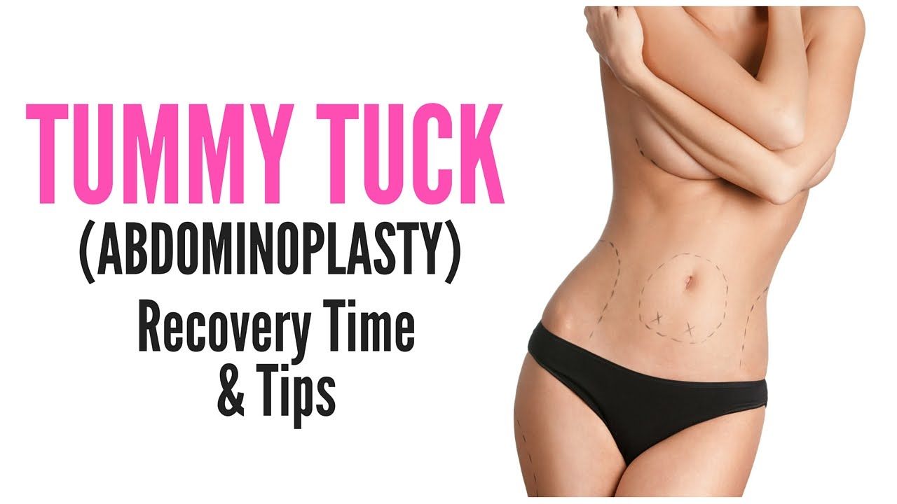 What will my Tummy Tuck Recovery be like? Recovery Timeline from Start to Finish
