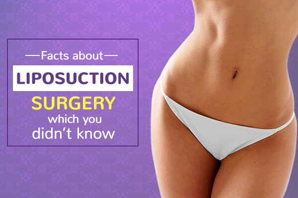 Must Know Facts about Liposuction 360 