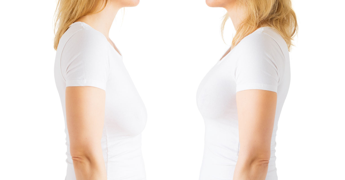 Understanding the Difference Between a Breast Lift and Breast Augmentation