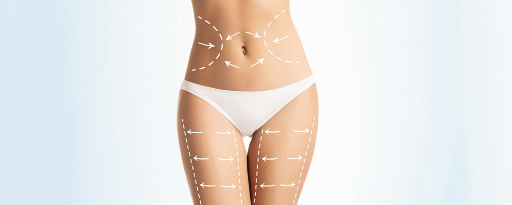 Sculpting Perfection: Liposuction and Body Contouring
