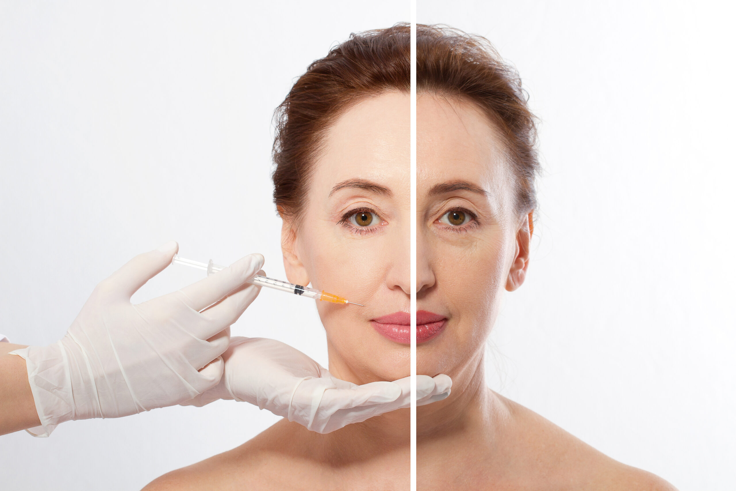 Aging Gracefully: The Role of Dermal Fillers in Facial Rejuvenation