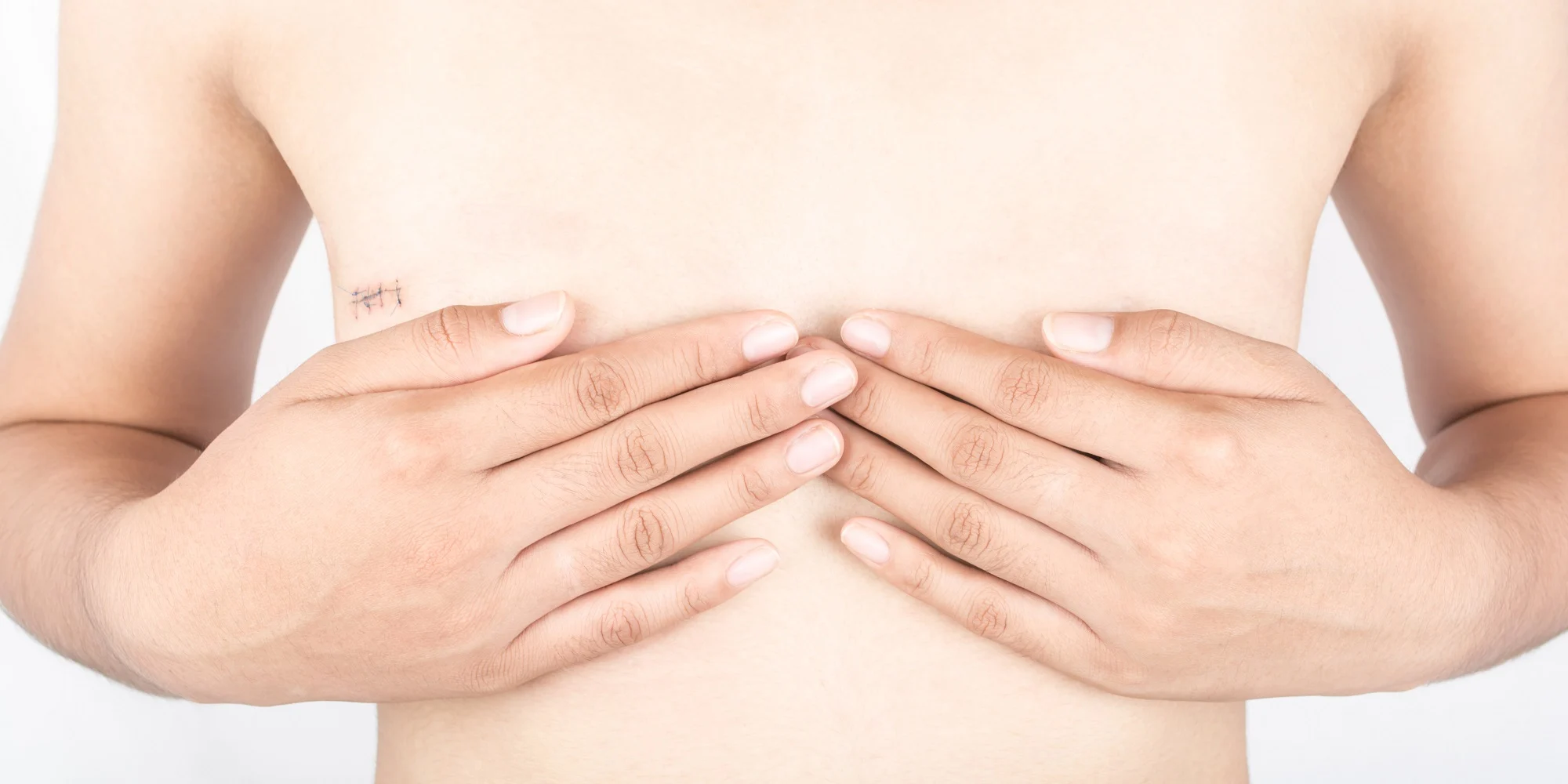 Choosing the Right Breast Reconstruction: Options After Mastectomy