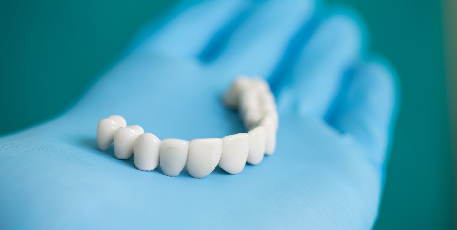 Dental Veneers, Options, Procedures And Costs