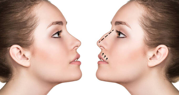 How To Choose the Best Rhinoplasty Surgeon in Bangalore?