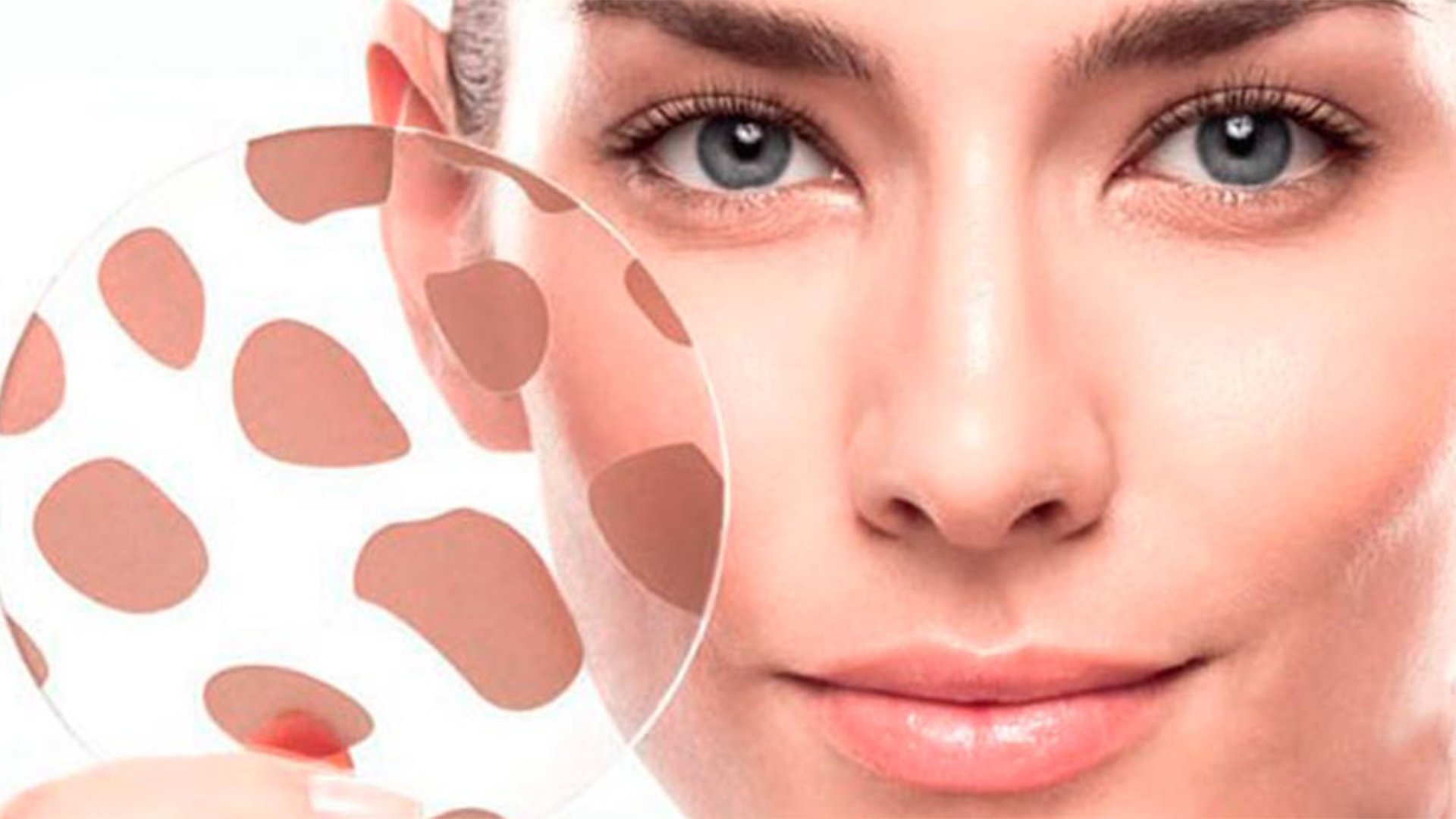 How to treat Dark Spots | Melasma| Hyperpigmentation on the Skin