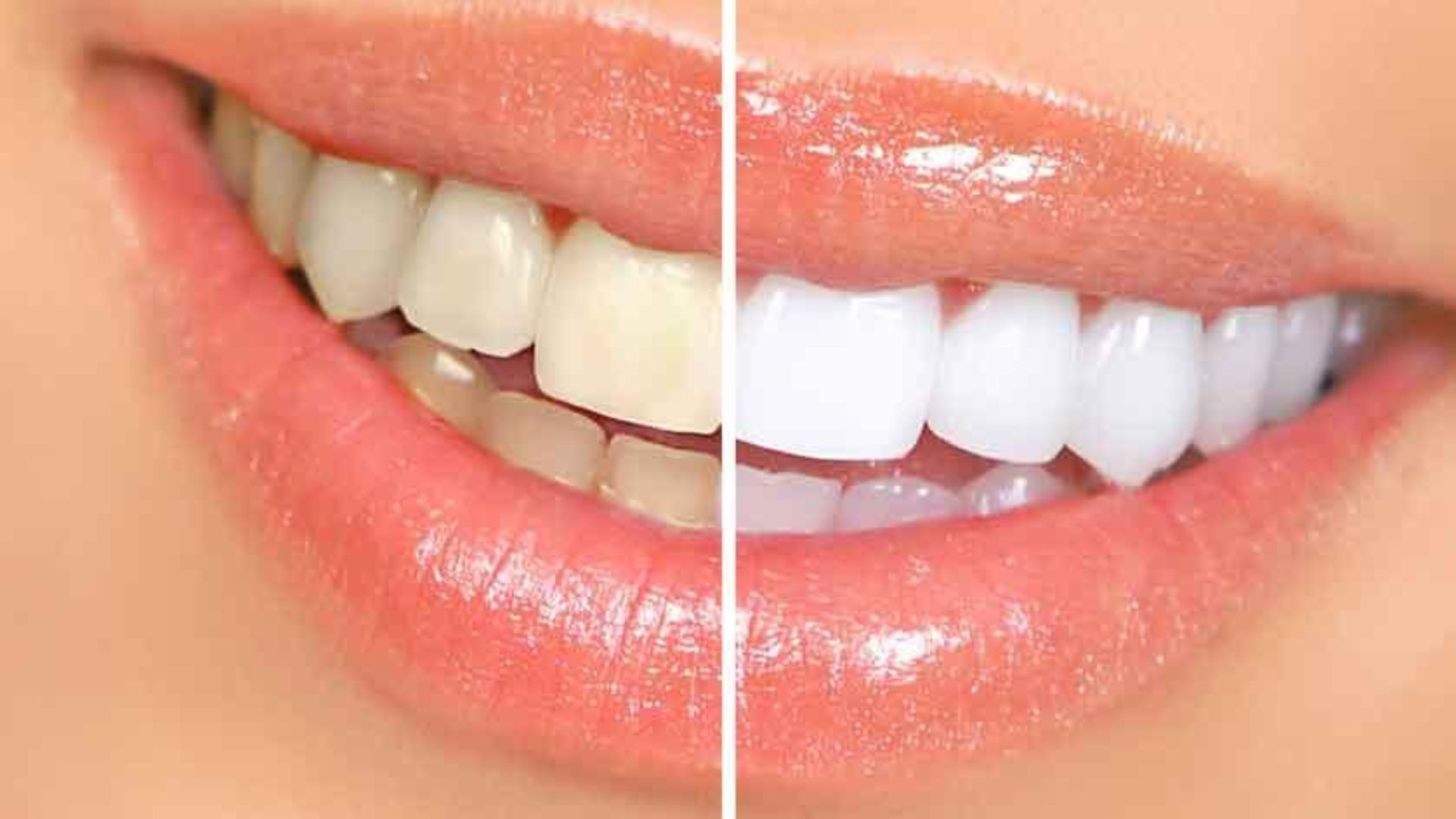 Dentists Unveil Four Fruits For Natural Teeth Whitening