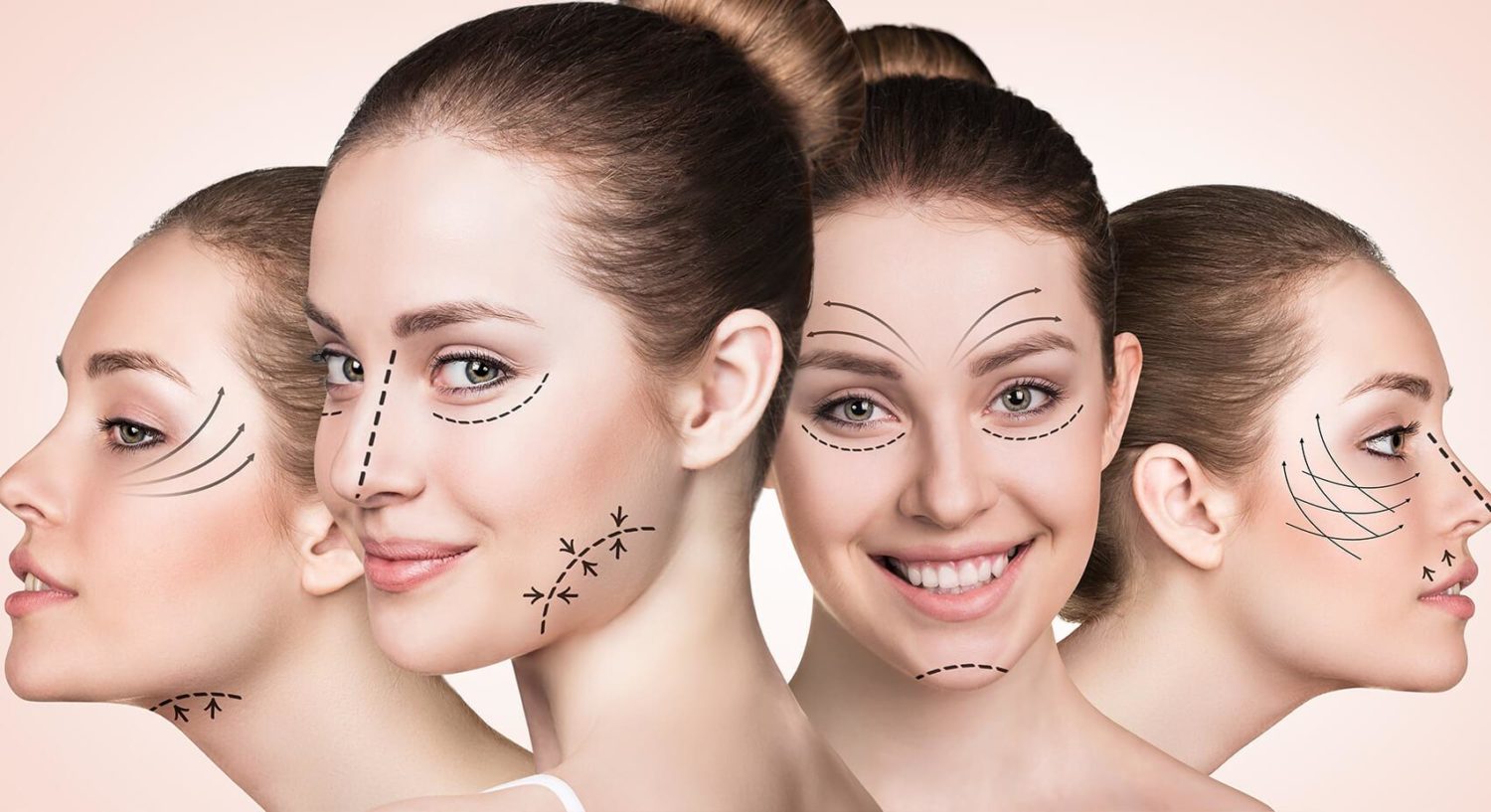5 Most Common Plastic Surgery Myths & Facts