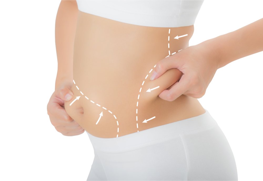 Is Liposuction Safe? How to Reduce the Risks/ Side Effects