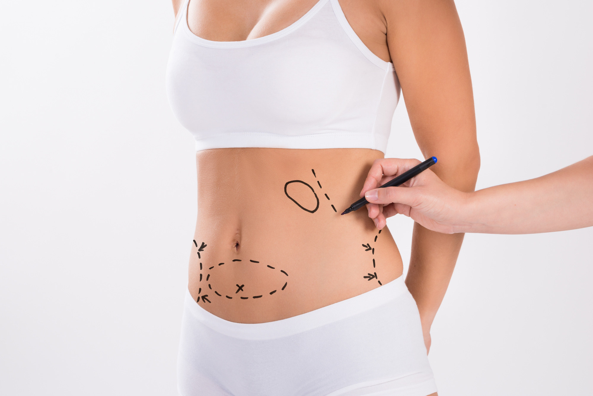 7 Important Things that You Should Know Before Tummy Tuck Surgery