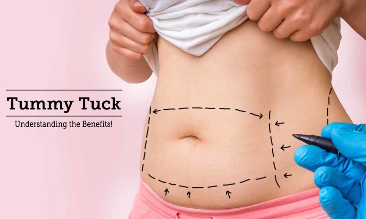FAQs about Tummy tuck Surgery?