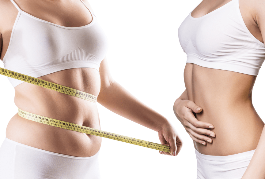 What Questions Should I ask Before getting Liposuction?