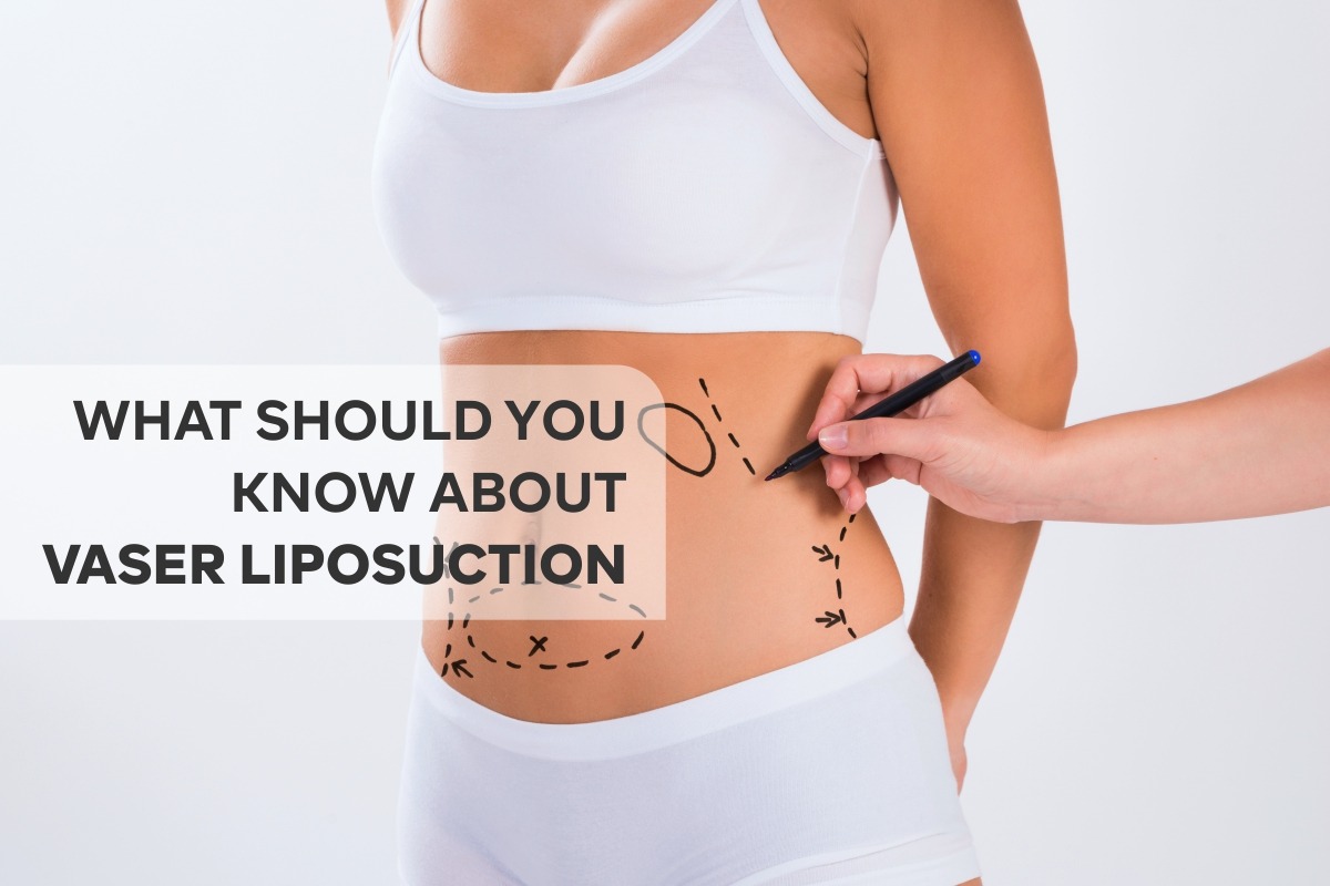 What Should You Know about VASER Liposuction