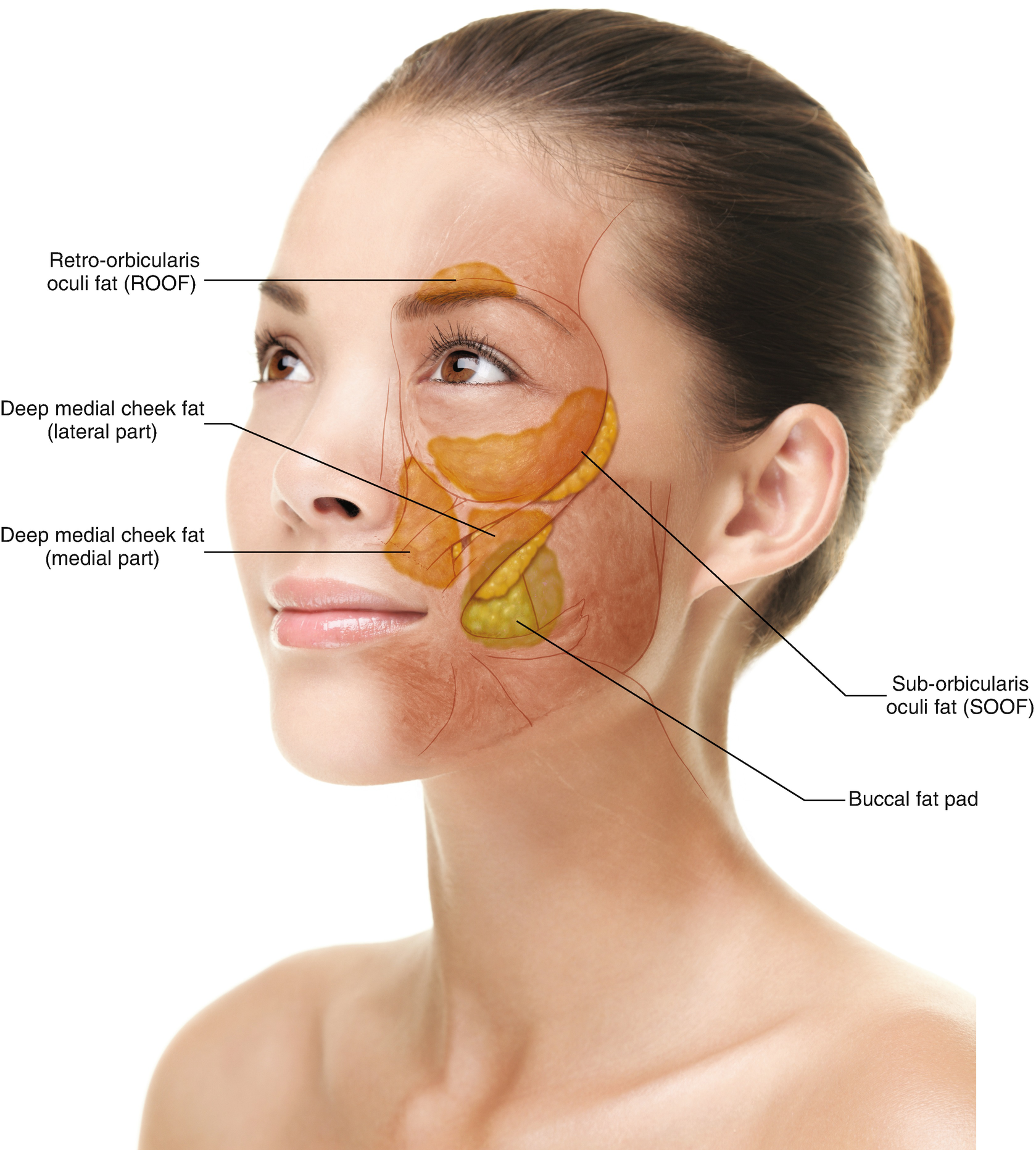 Top 5 Things You Should Know about Buccal Fat Removal/ Cheek Reduction Surgery