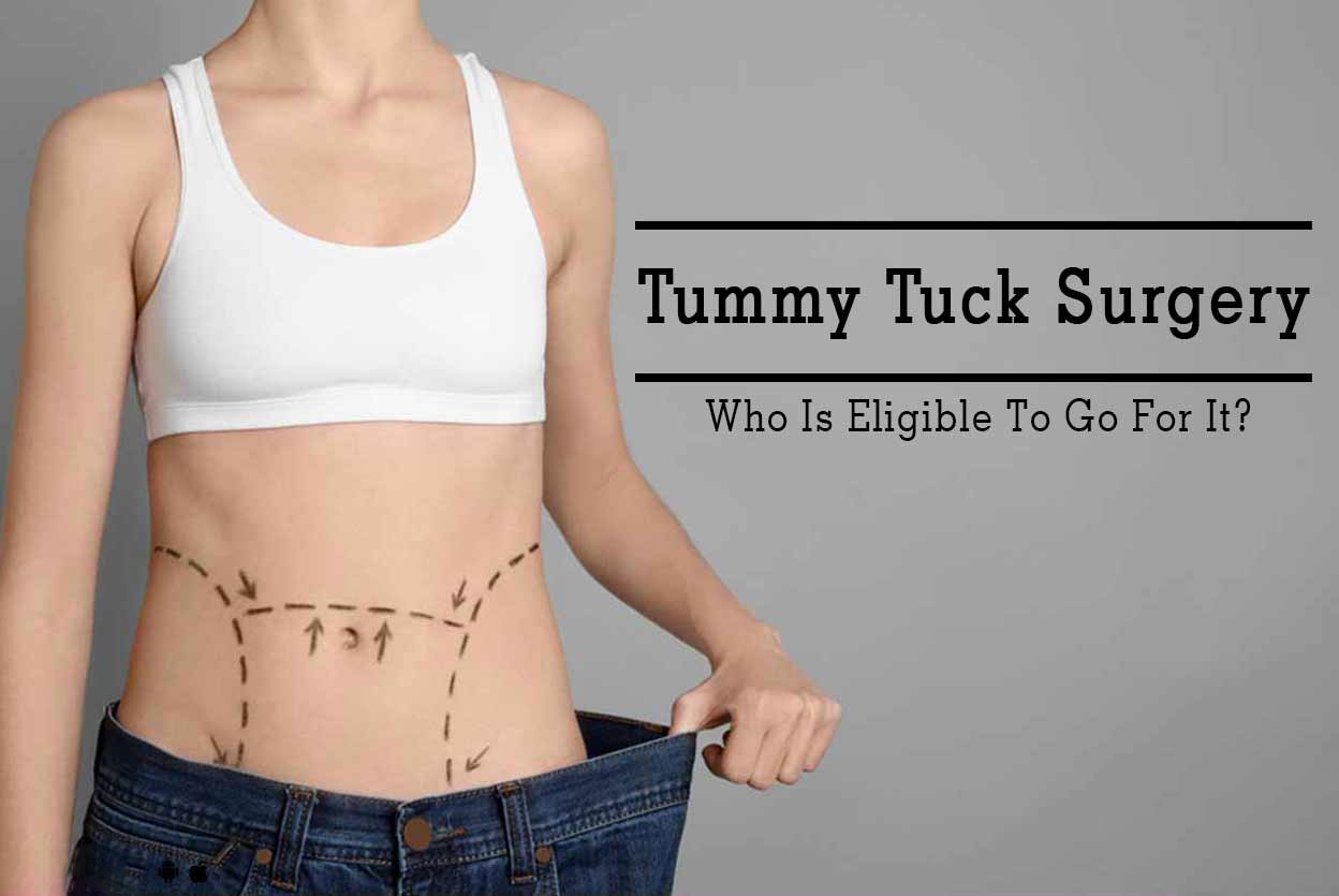 Who is the Right Candidate for Tummy Tuck Surgery