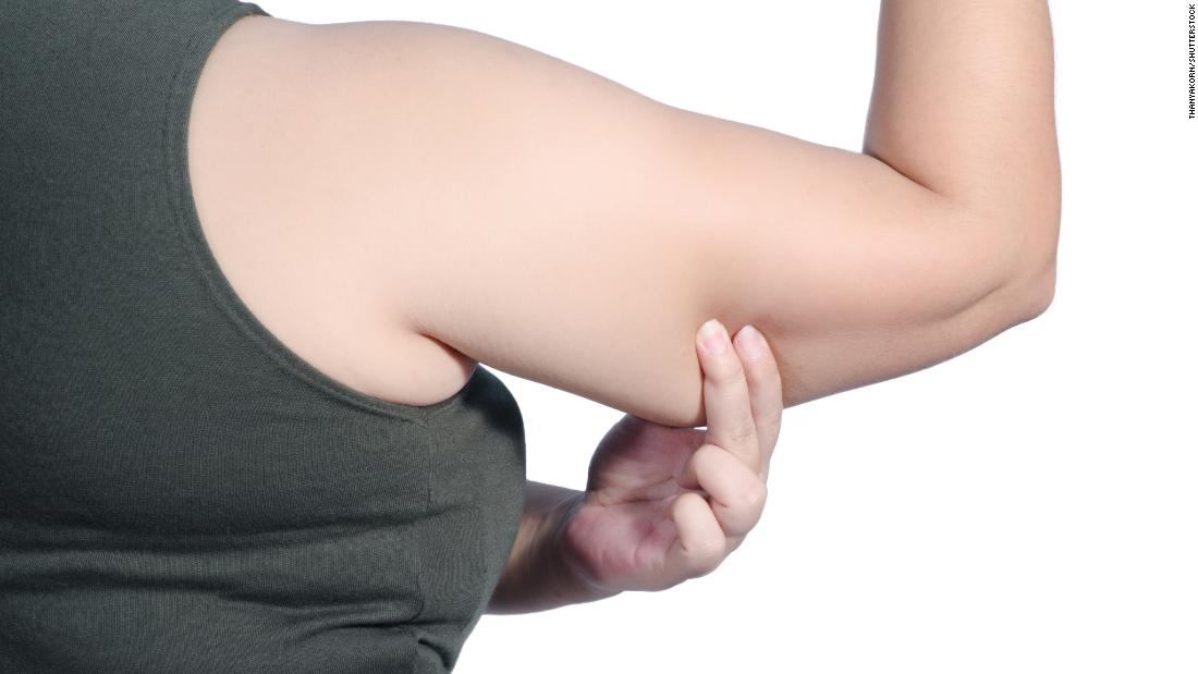 Got Flabby, fatty, and saggy Arms? Here’s What Can You Do About them  