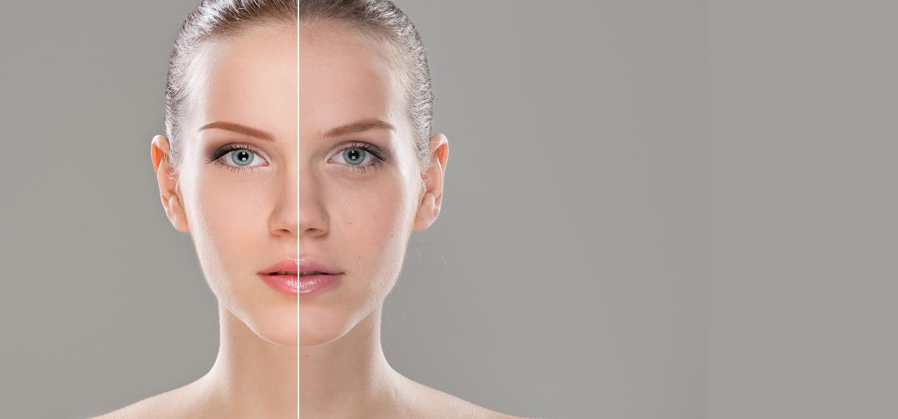 Scar Revision and Skin Rejuvenation: Unlocking Your Skin's Potential