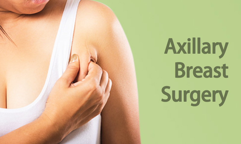 Dos And Don'ts to Follow After Axillary Breast Tissue Removal Surgery 