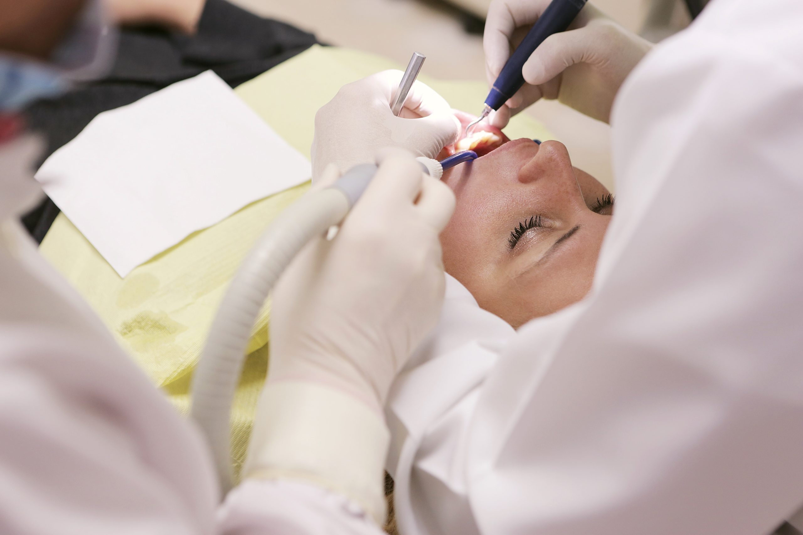 Buccal Fat Removal: Everything You Need To Know About This Trending Procedure