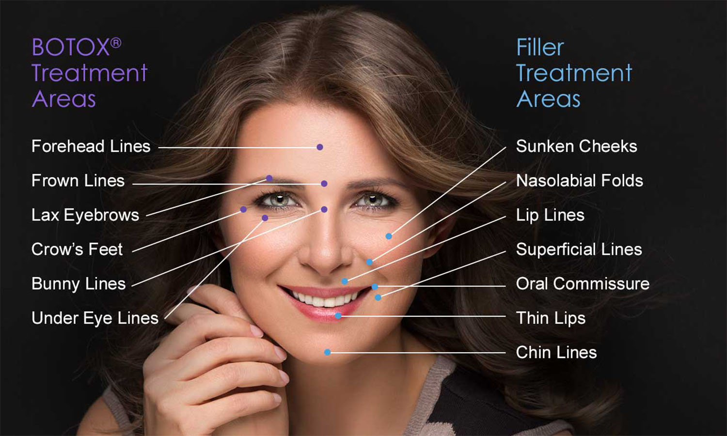Botox vs. Fillers: Which One Is the Best for You?
