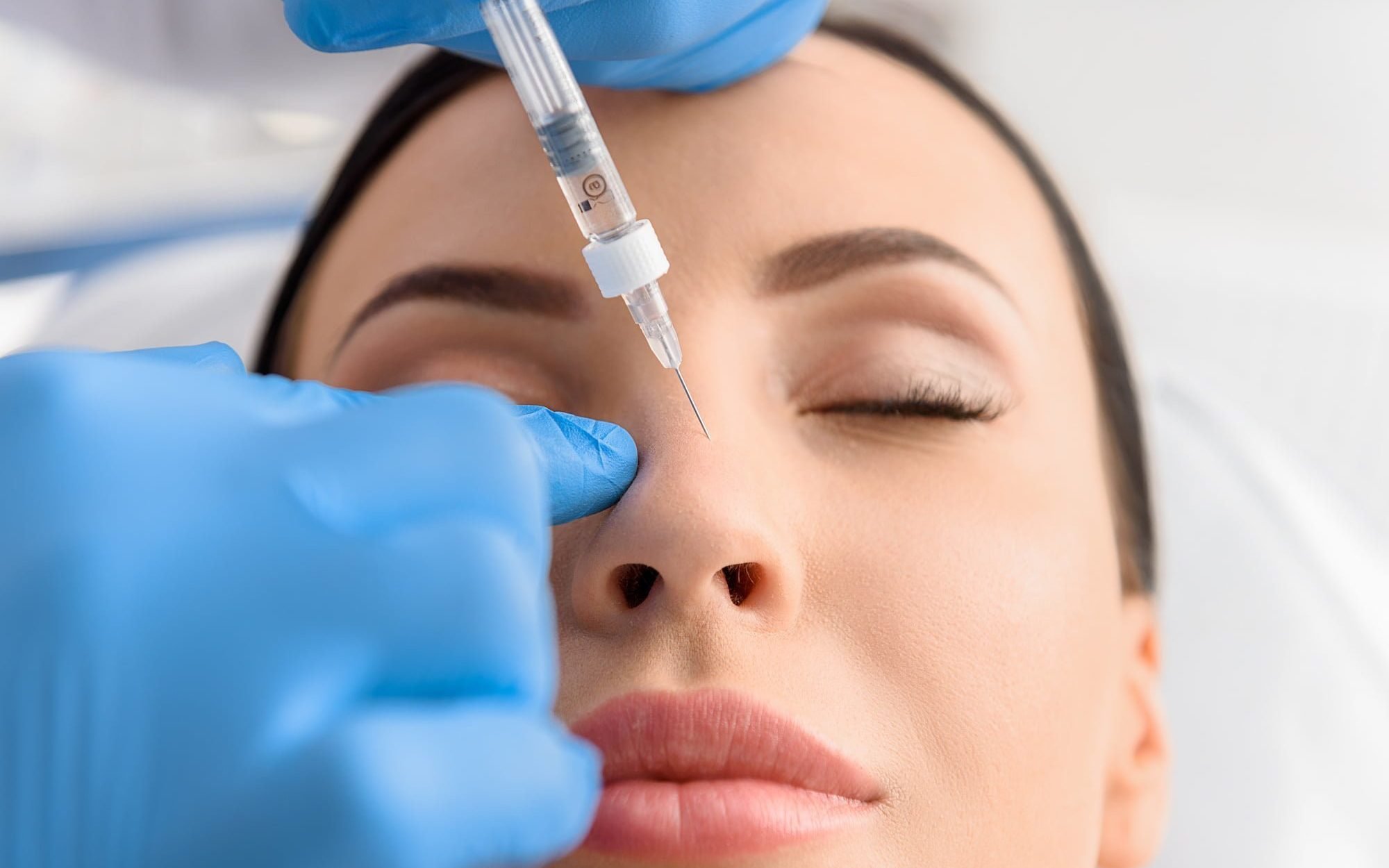 Top 5 Misconceptions About Non-Surgical Rhinoplasty