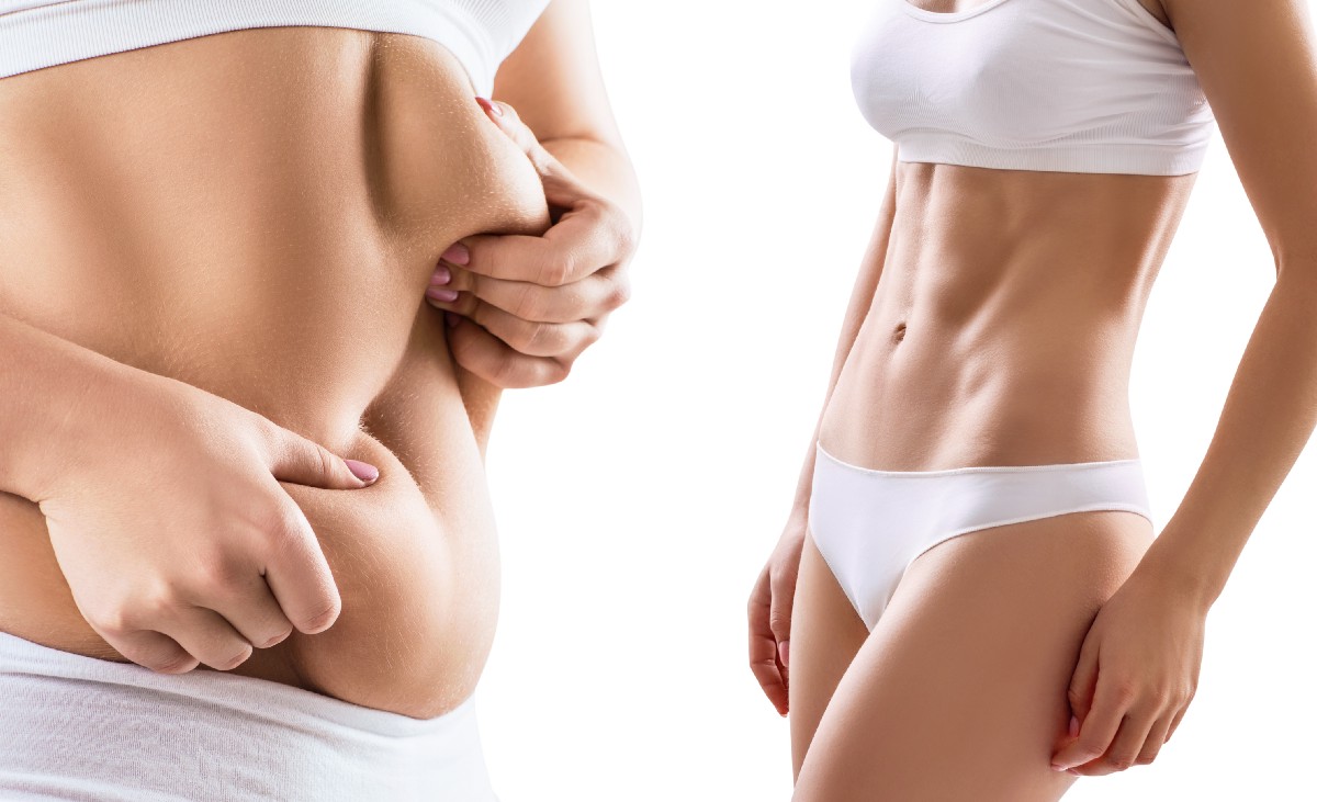 Top 4 Benefits of Body Contouring Surgery