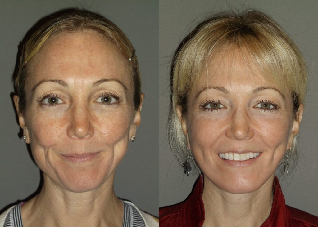 Am I too old for Plastic Surgery