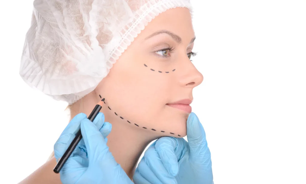 What Can I Achieve with Facelift Surgery?