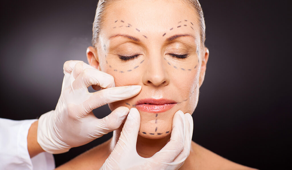 Lifting Your Spirits: Understanding Facelift Surgery