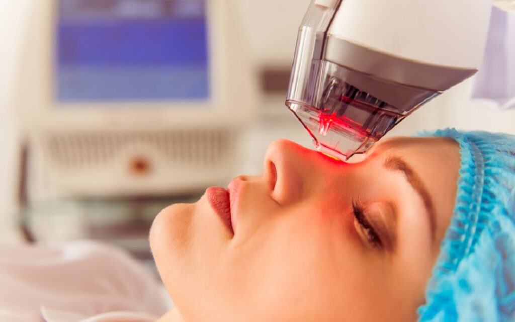 CO2 Laser Resurfacing