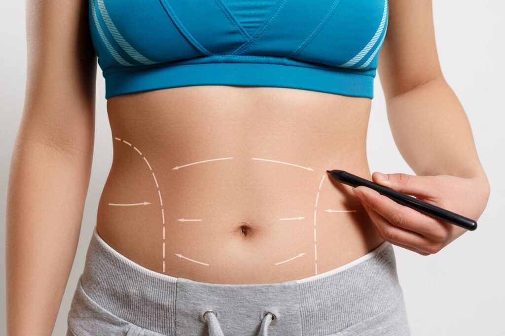 Liposuction Cost in Bangalore