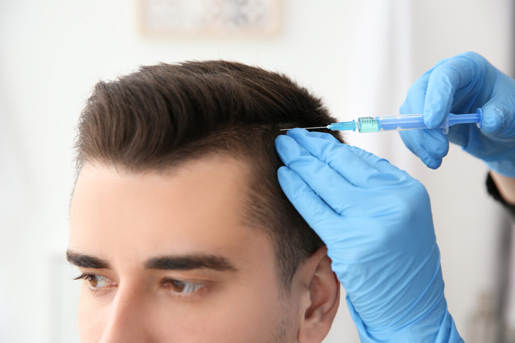 Why Choose PRP Over Traditional Hair Transplant