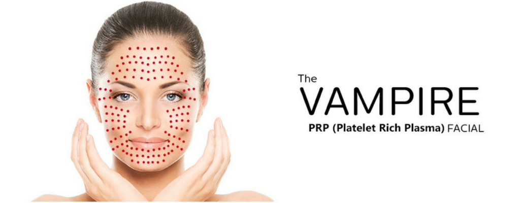 What are the key Advantages of a Vampire Facial