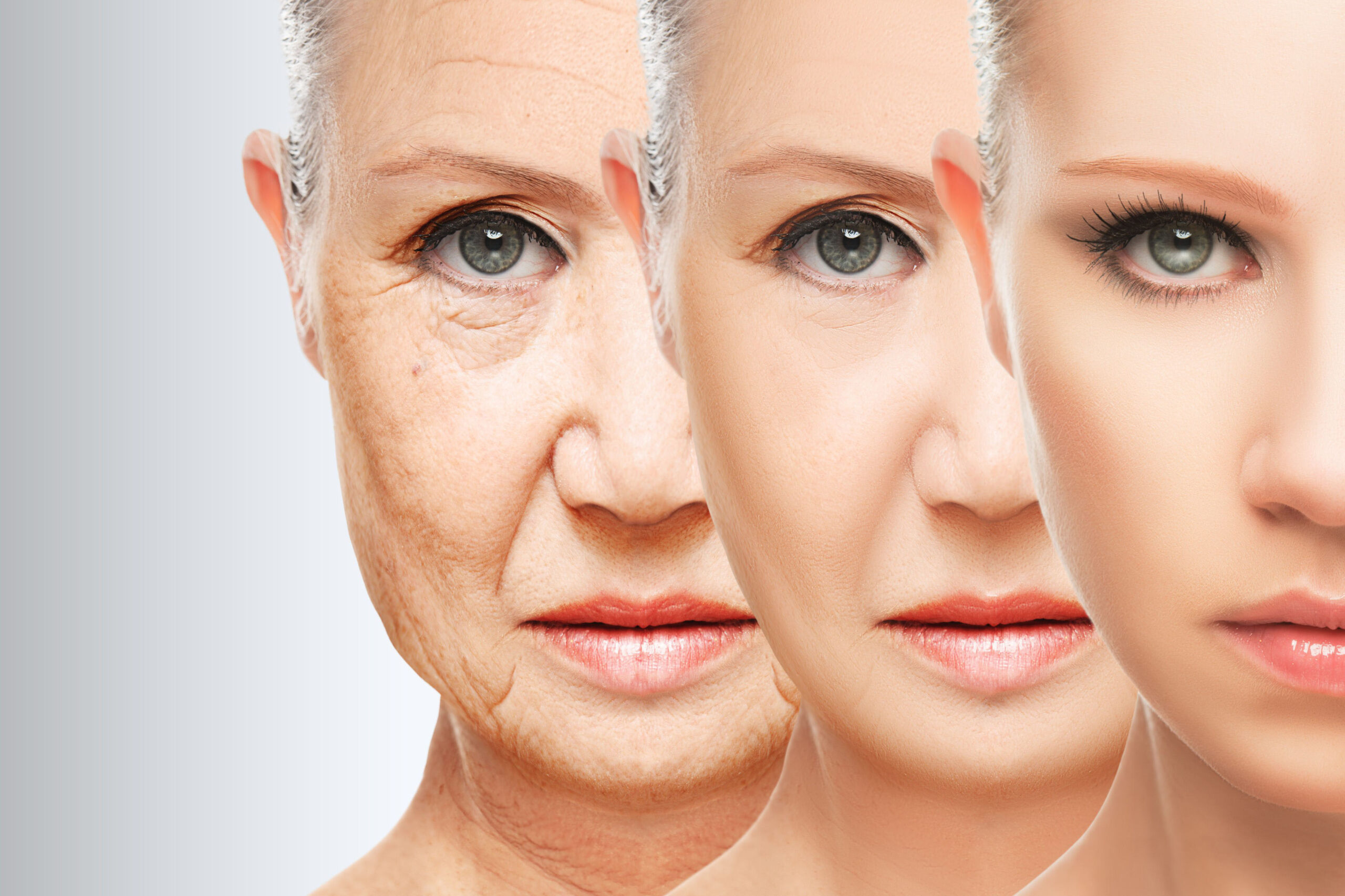 Non-Surgical Anti-Aging Treatments