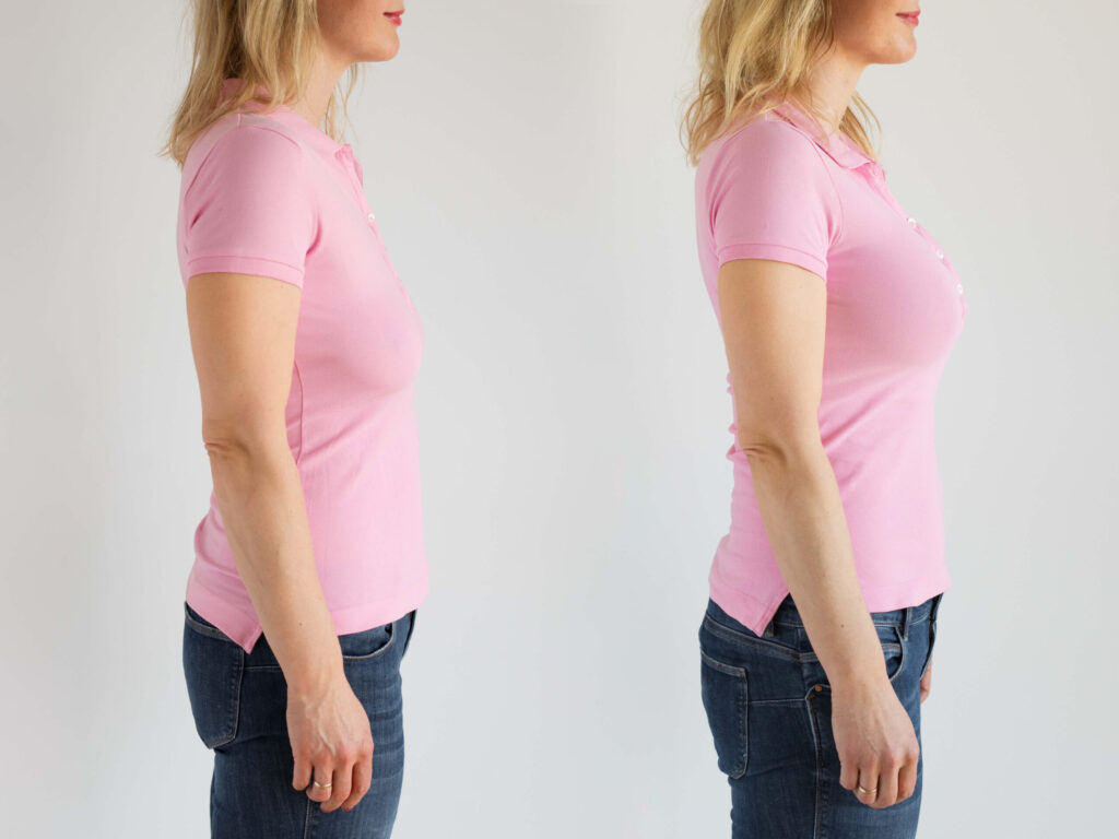 Top 5 Important Things before getting Breast Implant