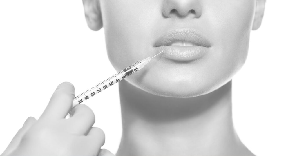 What are the Top 4 Benefits that make Lip fillers a worth Decision