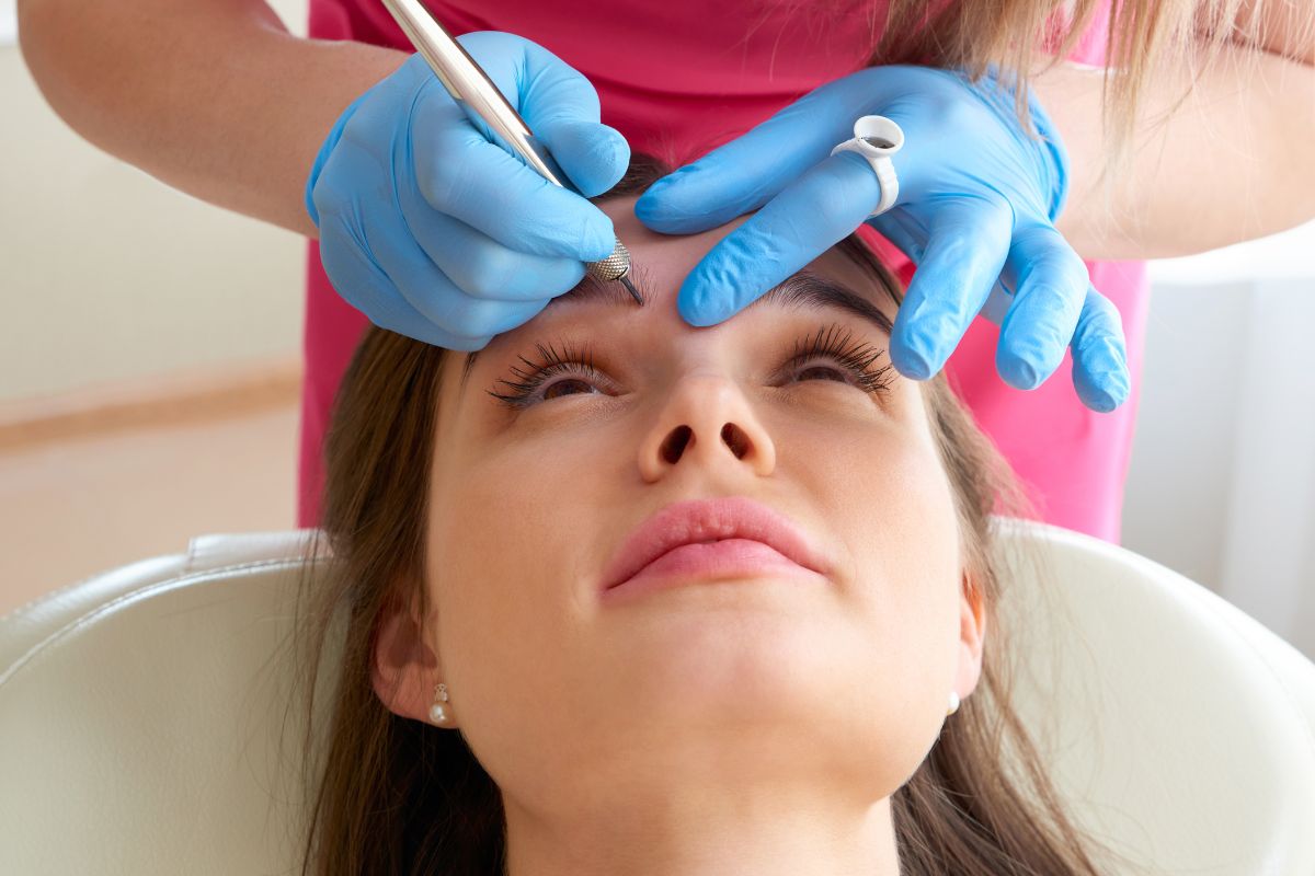 brow lift