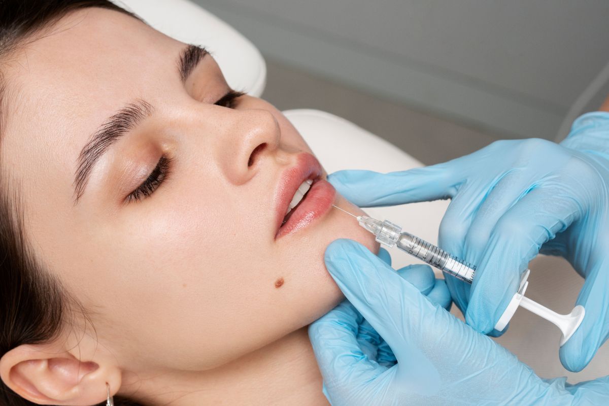 Lip Fillers in Bangalore – Price, Results, Side Effects & What You Should Know Before Getting It. 
