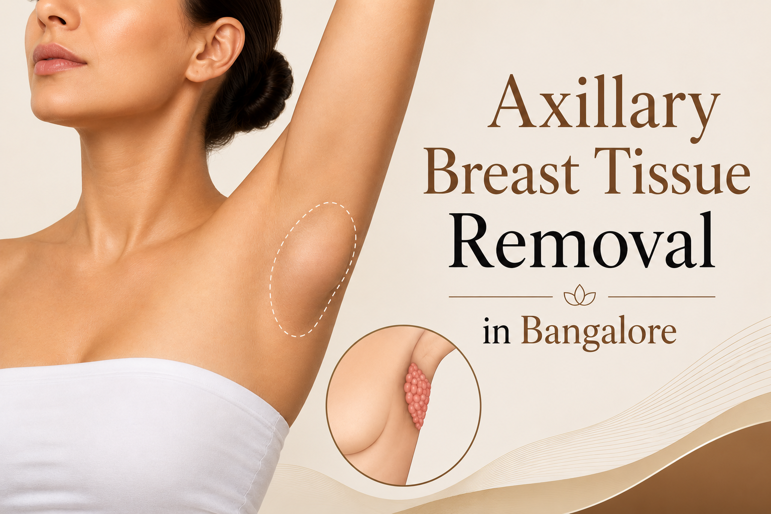 Axillary Breast Tissue Removal in Bangalore
